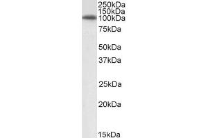Image no. 4 for anti-Heat Shock Protein 90kDa beta (Grp94), Member 1 (HSP90B1) (Internal Region) antibody (ABIN185655)