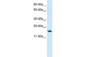 Image no. 1 for anti-High Mobility Group Box 3 (HMGB3) (C-Term) antibody (ABIN2776438)