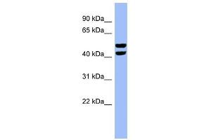 Image no. 1 for anti-6-phosphofructo-2-Kinase/fructose-2,6-Biphosphatase 4 (PFKFB4) (N-Term) antibody (ABIN632373)
