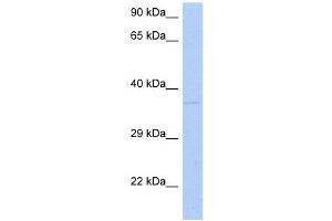 Image no. 1 for anti-Developmentally Regulated GTP Binding Protein 1 (DRG1) (N-Term) antibody (ABIN631677)