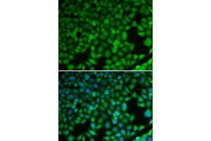 Image no. 3 for anti-N-Myc Downstream Regulated 1 (NDRG1) antibody (ABIN3023026)