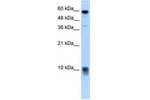 Image no. 2 for anti-S100 Calcium Binding Protein A3 (S100A3) (N-Term) antibody (ABIN204985)