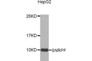 Image no. 1 for anti-Small Nuclear Ribonucleoprotein Polypeptide F (SNRPF) antibody (ABIN1682845)
