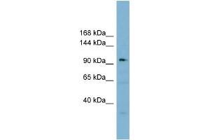Image no. 1 for anti-Squamous Cell Carcinoma Antigen Recognized By T Cells 3 (SART3) (Middle Region) antibody (ABIN2780945)
