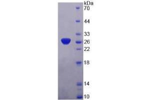 Image no. 1 for Synaptosomal-Associated Protein, 25kDa (SNAP25) protein (ABIN6119697)