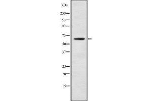 Image no. 2 for anti-Kelch-Like 3 (KLHL3) antibody (ABIN6262847)