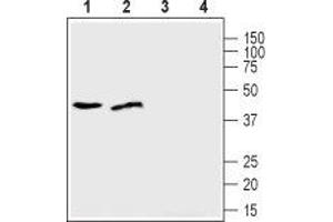 SLC39A1 anticorps  (Extracellular, N-Term)