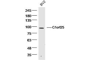 Image no. 1 for anti-TRM1 tRNA Methyltransferase 1-Like (TRMT1L) antibody (ABIN1387165)