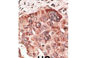 Image no. 2 for anti-Recoverin (RCVRN) (AA 169-200), (C-Term) antibody (ABIN5532073)