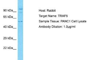 Image no. 2 for anti-TNF Receptor-Associated Factor 6 (TRAF6) (C-Term) antibody (ABIN2779328)