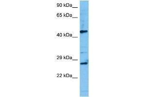 Image no. 2 for anti-Transcription Factor 7 (T-Cell Specific, HMG-Box) (TCF7) (N-Term) antibody (ABIN2776020)