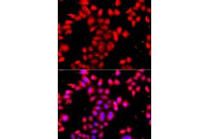 Image no. 3 for anti-O-Sialoglycoprotein Endopeptidase-Like 1 (OSGEPL1) antibody (ABIN6145070)