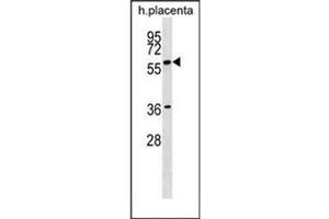 GAB3 antibody  (N-Term)