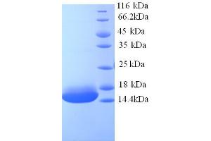 Image no. 1 for Cyclin J-Like (CCNJL) (AA 315-435), (partial) protein (His tag) (ABIN5713328)