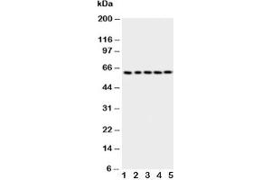 Image no. 4 for anti-T-Complex 1 (TCP1) (AA 82-98) antibody (ABIN3029087)