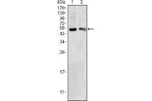 Image no. 1 for anti-3-hydroxybutyrate Dehydrogenase, Type 1 (BDH1) antibody (ABIN1724721)
