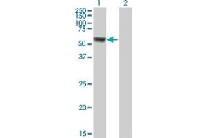 ACSF3 antibody  (AA 1-576)