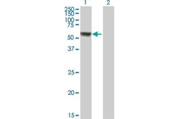ACSF3 antibody  (AA 1-576)