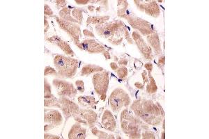Image no. 2 for anti-Very Low Density Lipoprotein (VLDL) (AA 484-510) antibody (ABIN5535682)