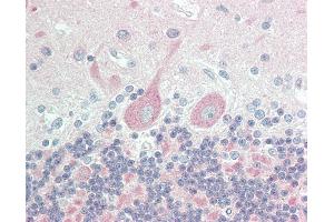 Image no. 1 for anti-Hippocalcin-Like 1 (HPCAL1) (C-Term) antibody (ABIN6755412)