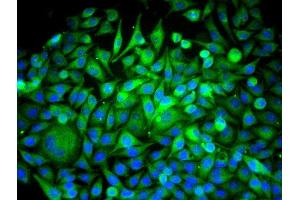 Image no. 8 for anti-Beclin 1, Autophagy Related (BECN1) (AA 201-330) antibody (ABIN675384)