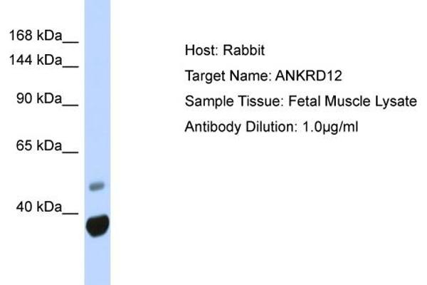 anti-Ankyrin Repeat Domain 12 (ANKRD12) (N-Term) antibody