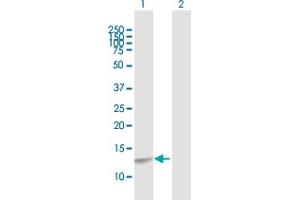anti-CAMP Responsive Element Binding Protein-Like 2 (CREBL2) (AA 1-120) antibody
