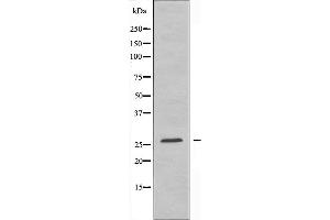 Image no. 1 for anti-Tetraspanin 8 (TSPAN8) antibody (ABIN6257540)
