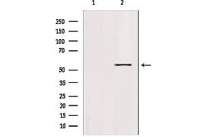 Image no. 2 for anti-Kruppel-Like Factor 11 (KLF11) (N-Term) antibody (ABIN6262840)