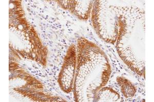 IHC-P Image Immunohistochemical analysis of paraffin-embedded human gastric , using MVP/LRP, antibody at 1:100 dilution.