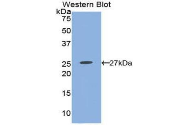 anti-Prostaglandin E Receptor 2 (Subtype EP2), 53kDa (PTGER2) (AA 155-355) antibody