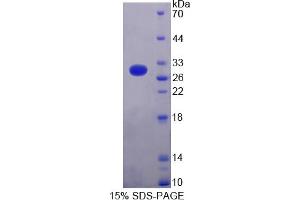 Image no. 1 for Cardiac Troponin I (TNNI3) (AA 2-211) protein (His tag) (ABIN6236657)