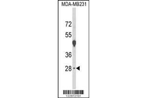 Image no. 1 for anti-Empty Spiracles Homeobox 1 (EMX1) (AA 228-257), (C-Term) antibody (ABIN652915)