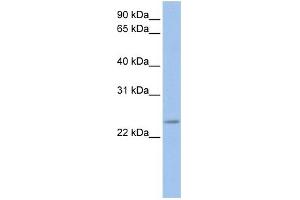 Image no. 2 for anti-FK506 Binding Protein 3, 25kDa (FKBP3) (C-Term) antibody (ABIN2785798)