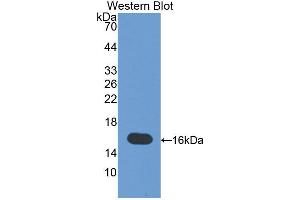anti-Melanoma Inhibitory Activity (MIA) (AA 23-130) antibody