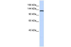 Image no. 1 for anti-Valyl-tRNA Synthetase (VARS) (Middle Region) antibody (ABIN631755)