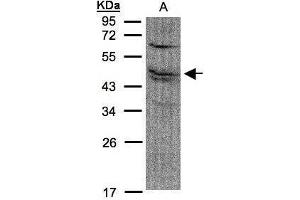 Image no. 2 for anti-Farnesyl-Diphosphate Farnesyltransferase 1 (FDFT1) (Center) antibody (ABIN2855767)