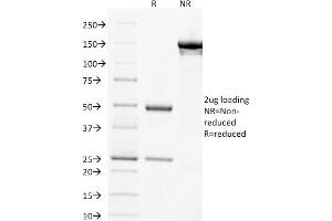 Image no. 7 for anti-Thymidylate Synthetase (TYMS) (AA 60-174) antibody (ABIN6940822)