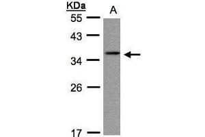 Image no. 1 for anti-Crystallin, gamma C (CRYGC) (Center) antibody (ABIN2854417)