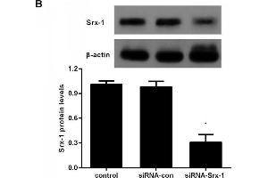 Image no. 5 for anti-Sulfiredoxin 1 (SRX1) (AA 45-137) antibody (ABIN1387599)