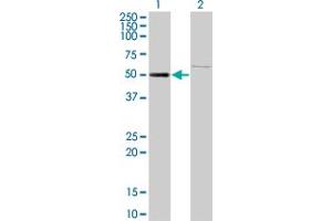 anti-Zinc Finger Protein 92 (ZNF92) (AA 490-586) antibody