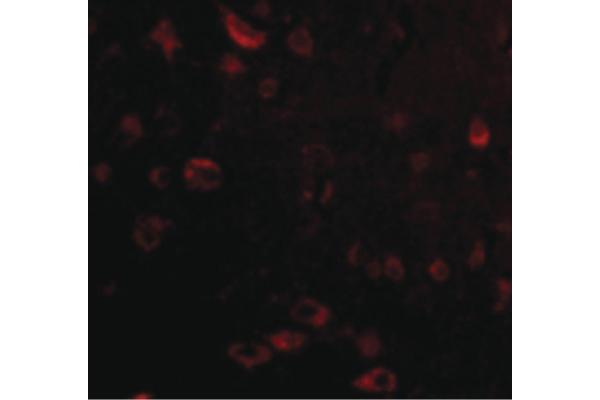 TIGAR antibody  (Internal Region)
