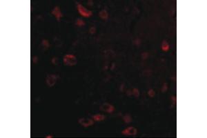 Image no. 2 for anti-TP53 induced glycolysis regulatory phosphatase (TIGAR) (Internal Region) antibody (ABIN6655743)