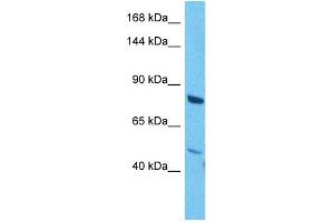 Image no. 2 for anti-Mitogen-Activated Protein Kinase Kinase Kinase 1 (MAP3K1) (C-Term) antibody (ABIN2783464)