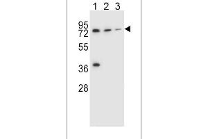 Image no. 1 for anti-UDP Glucuronosyltransferase 2 Family, Polypeptide B15 (UGT2B15) (AA 156-185) antibody (ABIN656309)