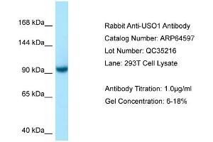 Image no. 1 for anti-USO1 Homolog, Vesicle Docking Protein (USO1) (C-Term) antibody (ABIN2789890)