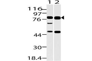 Image no. 1 for anti-Dachshund 1 (DACH1) (AA 300-550) antibody (ABIN5027130)