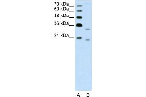 Image no. 1 for anti-Deoxyribonuclease II beta (DNASE2B) (C-Term) antibody (ABIN2775491)