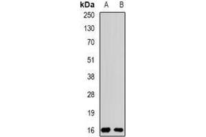 Image no. 1 for anti-Processing of Precursor 5, Ribonuclease P/MRP Subunit (POP5) (full length) antibody (ABIN6004568)