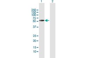 Image no. 4 for anti-Heat Shock 60kDa Protein 1 (Chaperonin) (HSPD1) (AA 1-573) antibody (ABIN947996)